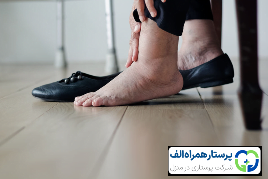 نکات مهم برای مراقبت از پای سالمندان 22 پرستار همراه الف